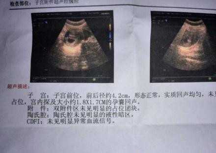 上海招代妈：免疫方面对代孕影响大吗