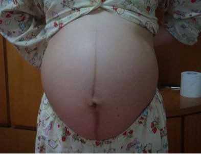子宫切除怀孕吗_子宫囊肿切除怀孕_俄罗斯试管婴儿有几种方案