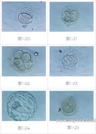 怀孕能切除子宫吗_胎停性染色体异常_试管婴儿胚胎移植具体过程及方式
